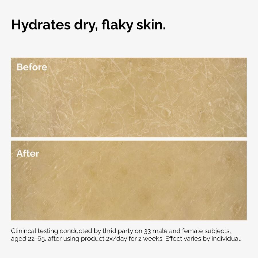 the-body-care-collection-d0 ord-natural-moisturizing-factors-inulin-body-before-after-graphic-02.jpg