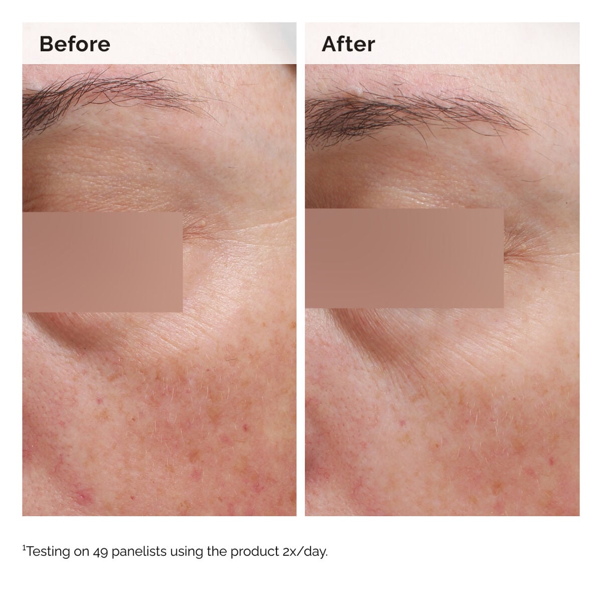 niacinamide-5-face-and-body-emulsion-g7 2024-08-23-ORD-Nia-5pct-Face-Body-B-A-Elasticity-Global-02-1x1.jpg