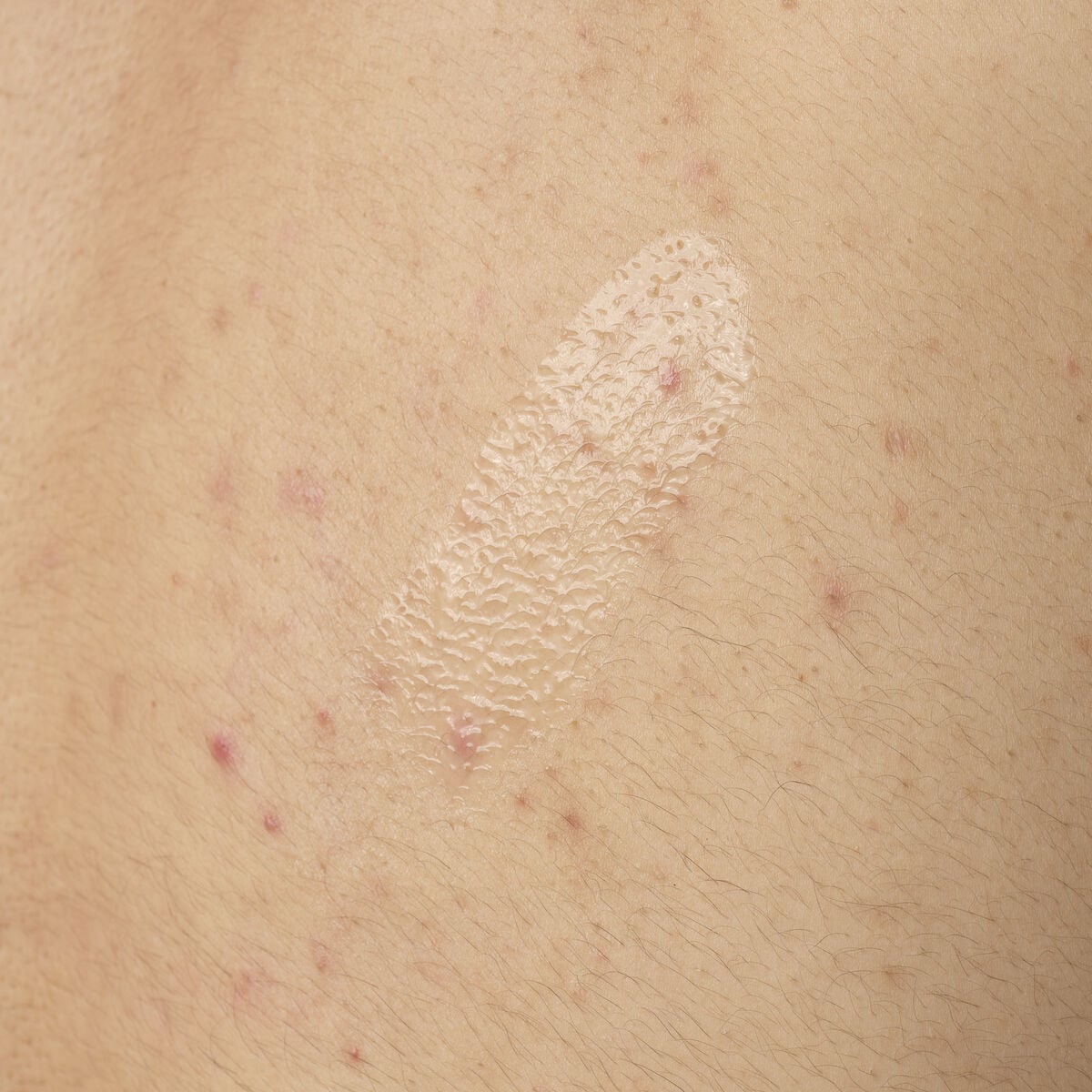 salicylic-acid-0-5-body-serum-w7 ORD-salicylic-acid-05-body-240ml-application.jpg
