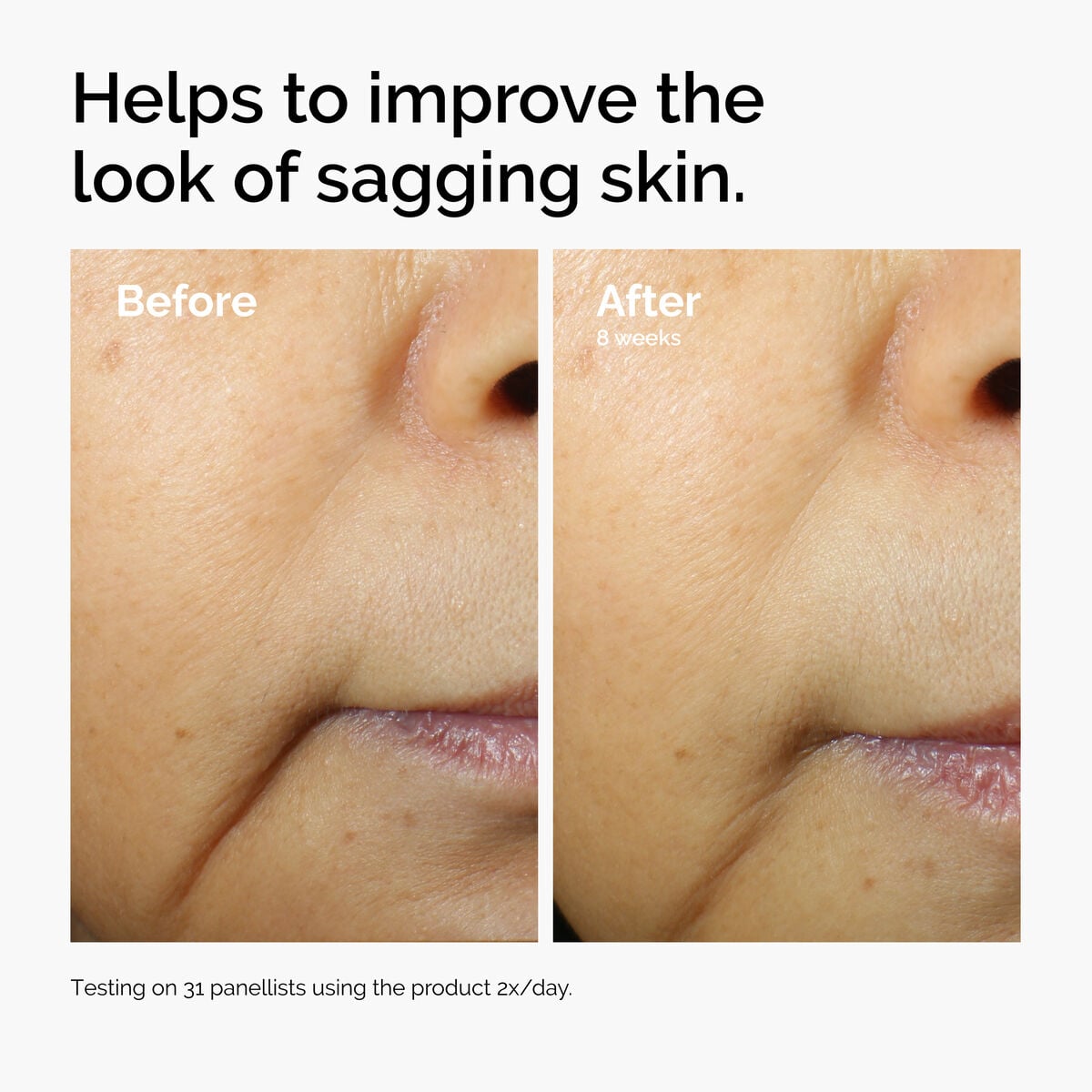 caffeine-3-escin-1-face-serum-n2 ord-caffeine-3pct-escin-1pct-face-serum-before-after-sagging.jpg