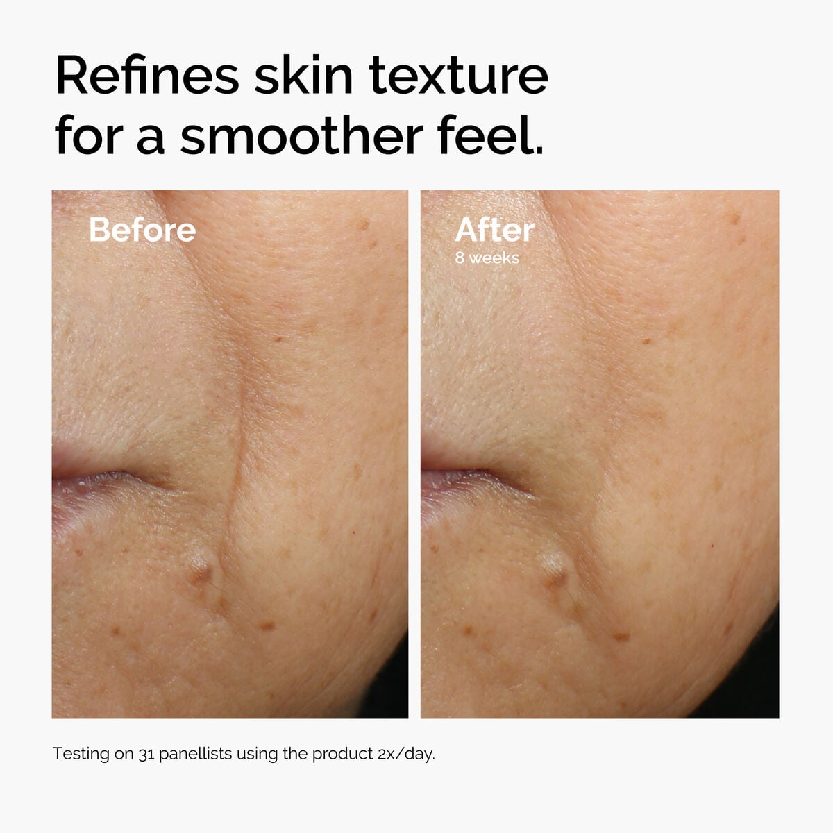 caffeine-3-escin-1-face-serum-n2 ord-caffeine-3pct-escin-1pct-face-serum-before-after-texture.jpg