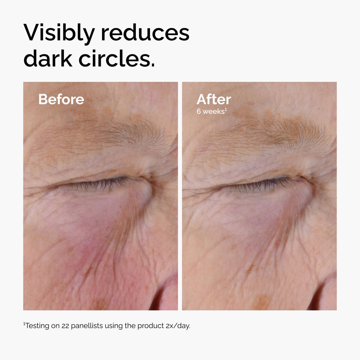 caffeine-solution-5-egcg-eye-serum-b0 ord-caffeine-solution-egcg-dark-circles-before-after.jpg