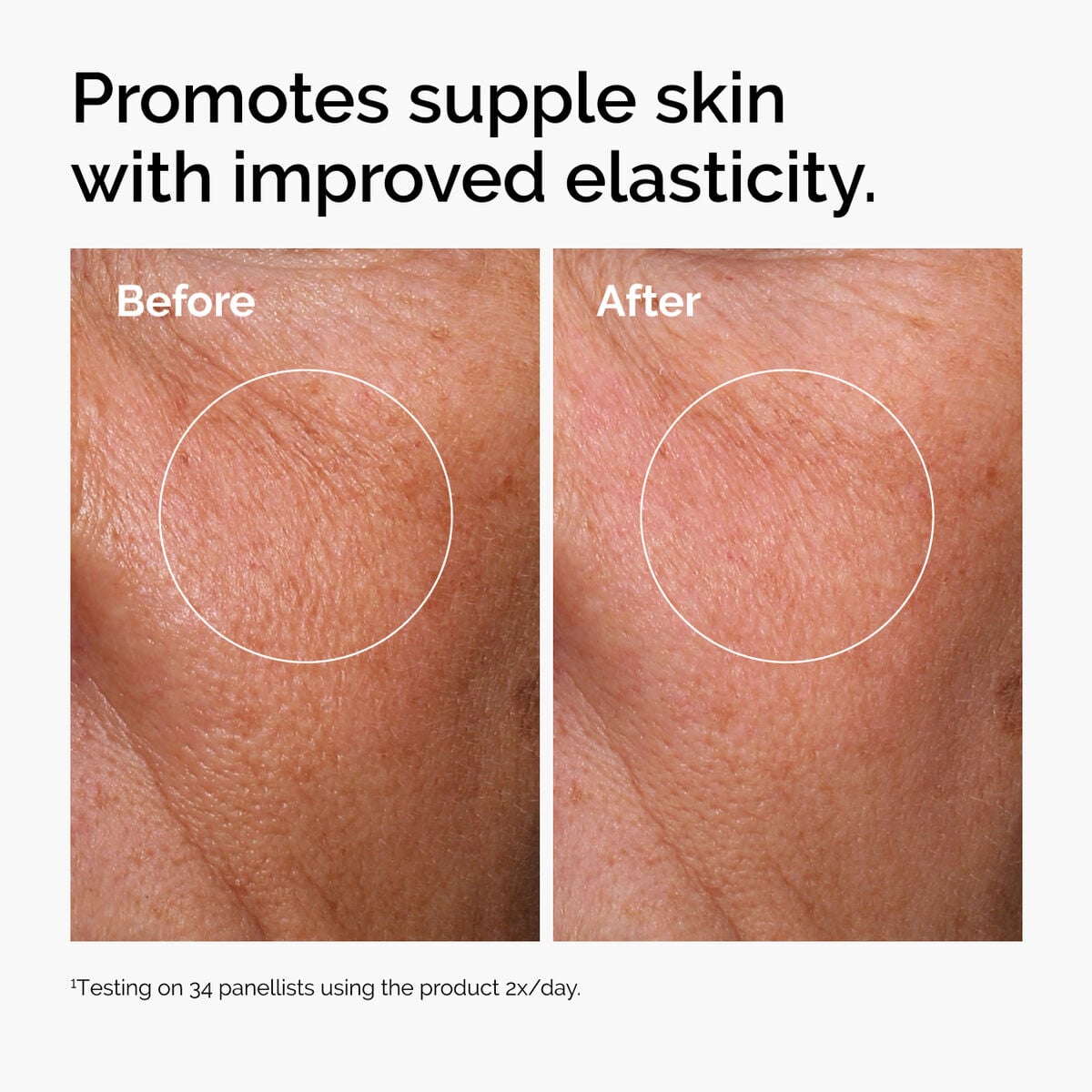 hyaluronic-acid-2-b5-with-ceramides-u1 ord-hyaluronic-acid-2pct-b5-hydrating-serum-before-after-elasticity.jpg