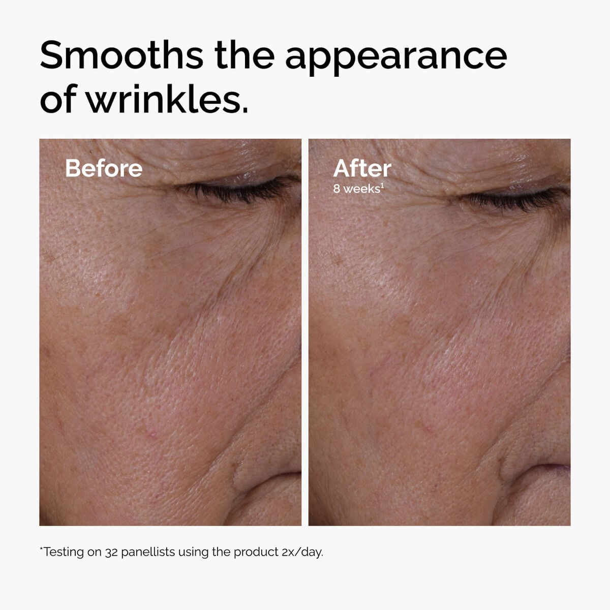 multi-peptide-ha-serum-i4 ord-multi-peptide-ha-serum-wrinkles-before-after.jpg