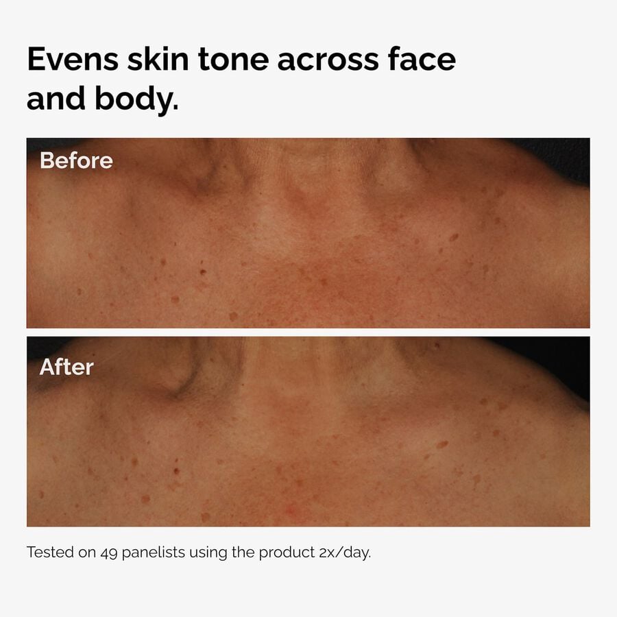 the-body-care-collection-d0 ord-niacinamide-face-body-serum-before-after-even-tone-graphic.jpg