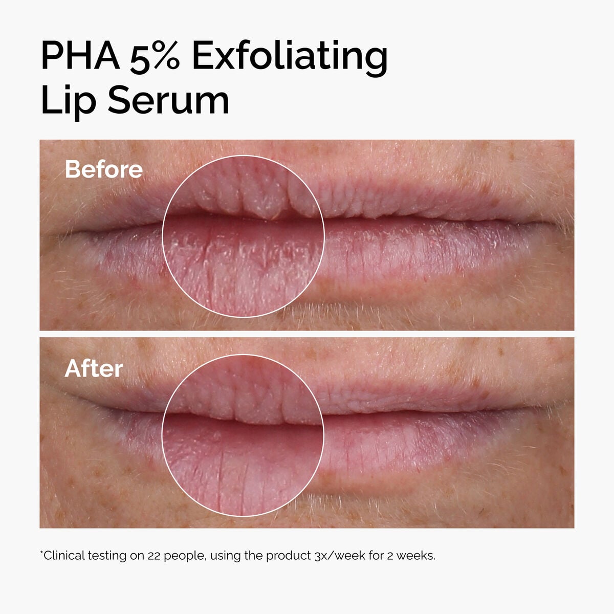 pha-5-exfoliating-lip-serum-g9 ord-pha-5pct-lip-exfoliating-serum-before-after.jpg